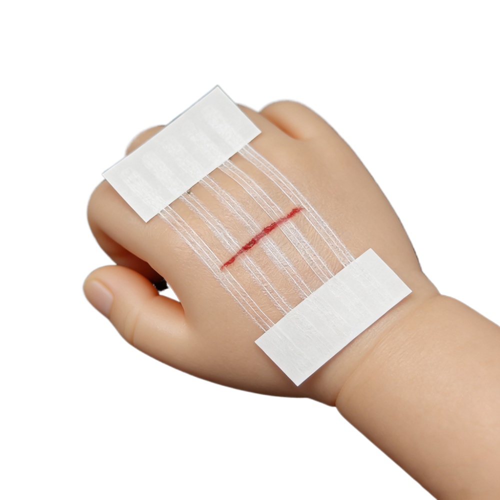 5 Pasków do Zamykania Ran, Pas – Medical Label recenzja i cena